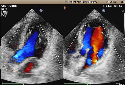 1742290505366.jpeg 1742290505366.jpeg