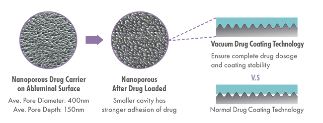 Polymer-free Stent Polymer-free Stent