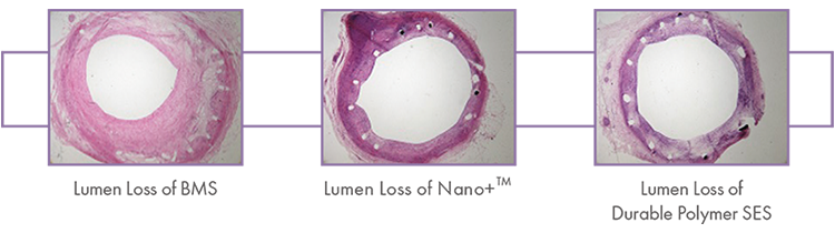 Polymer Free Stent Polymer Free Stent