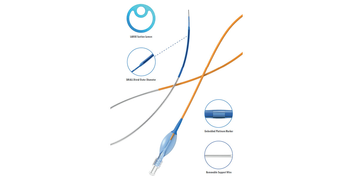 Thromsweeper™ Thrombus Extraction Catheter
