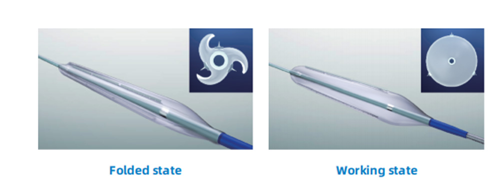 angiocide--peripheral-cutting-balloon-details.jpg angiocide--peripheral-cutting-balloon-details.jpg